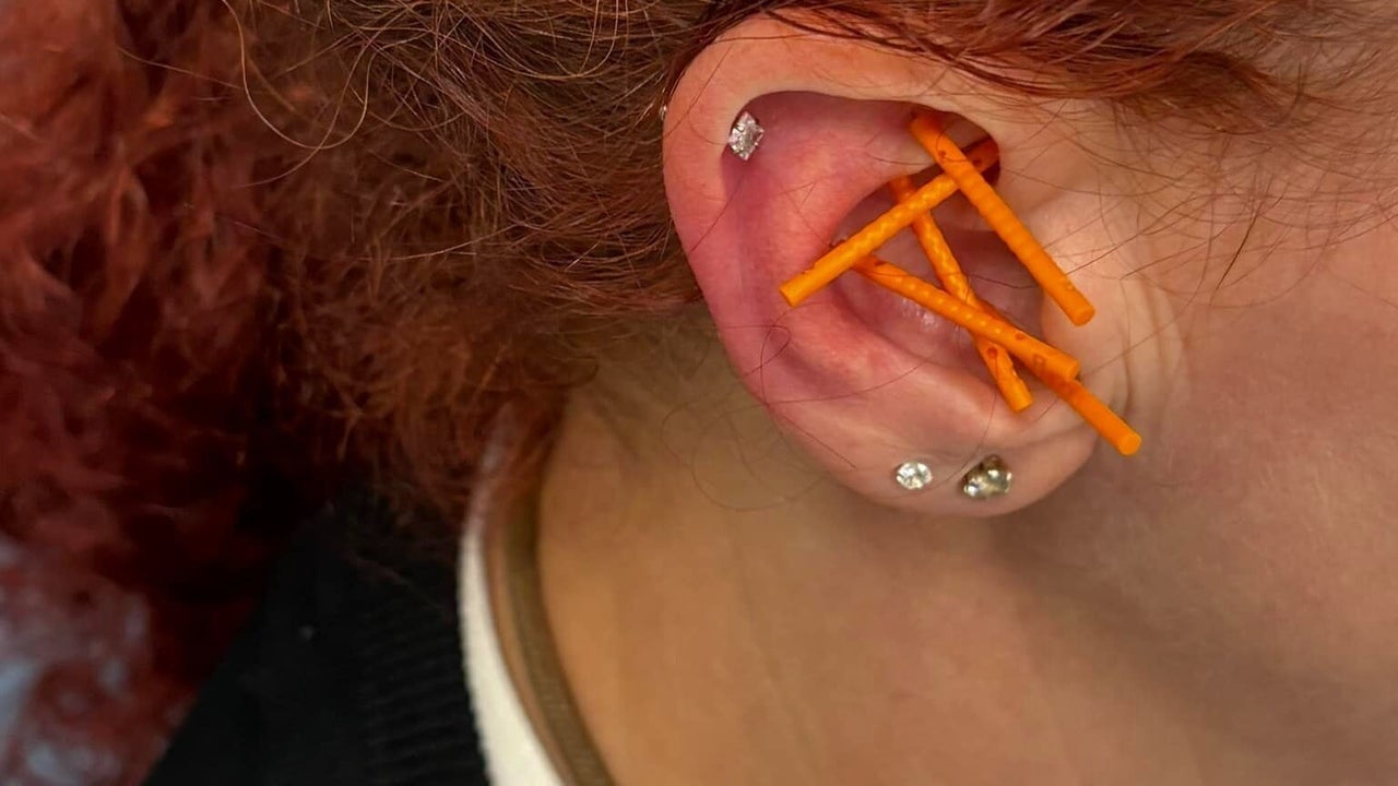 f509e887-479b-42ff-9cec-a51b104dde9b-deannathomasacupuncturewellbeing-gb-england-middlesbrough-acklam-fresha-1963731