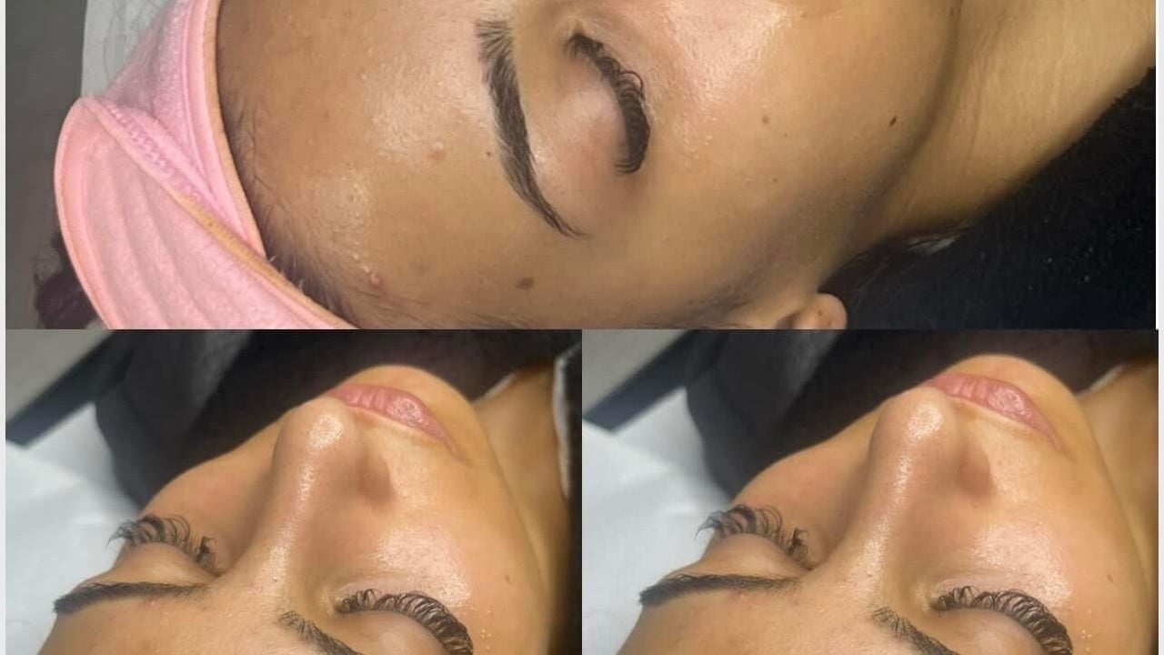 f61b2555-90d3-417b-8acd-ebdcc5ecdaf5-envymeaestheticsbeauty-gb-england-scunthorpe-fresha-3747797