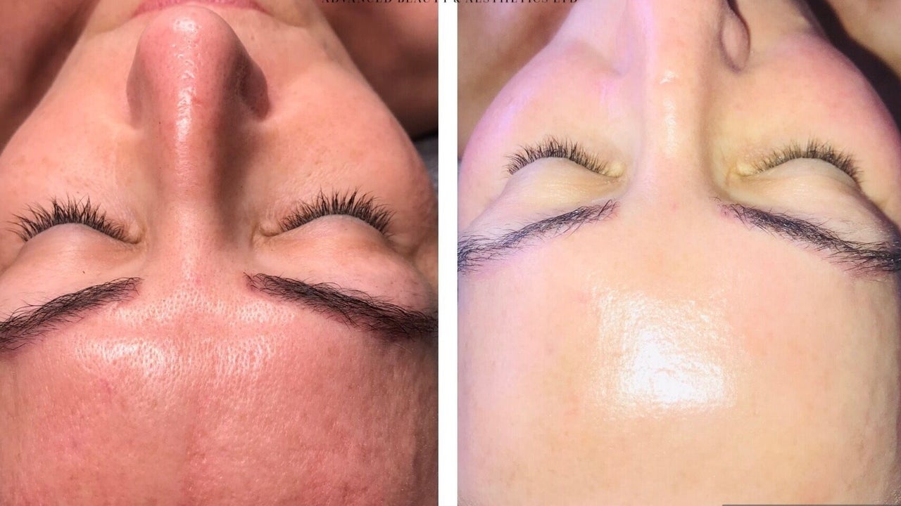 f80d6831-9442-4ad9-b1d0-4477adaa98e8-louisepynenadvancedbeautyaestheticsltd-gb-england-emsworth-fresha-6743935