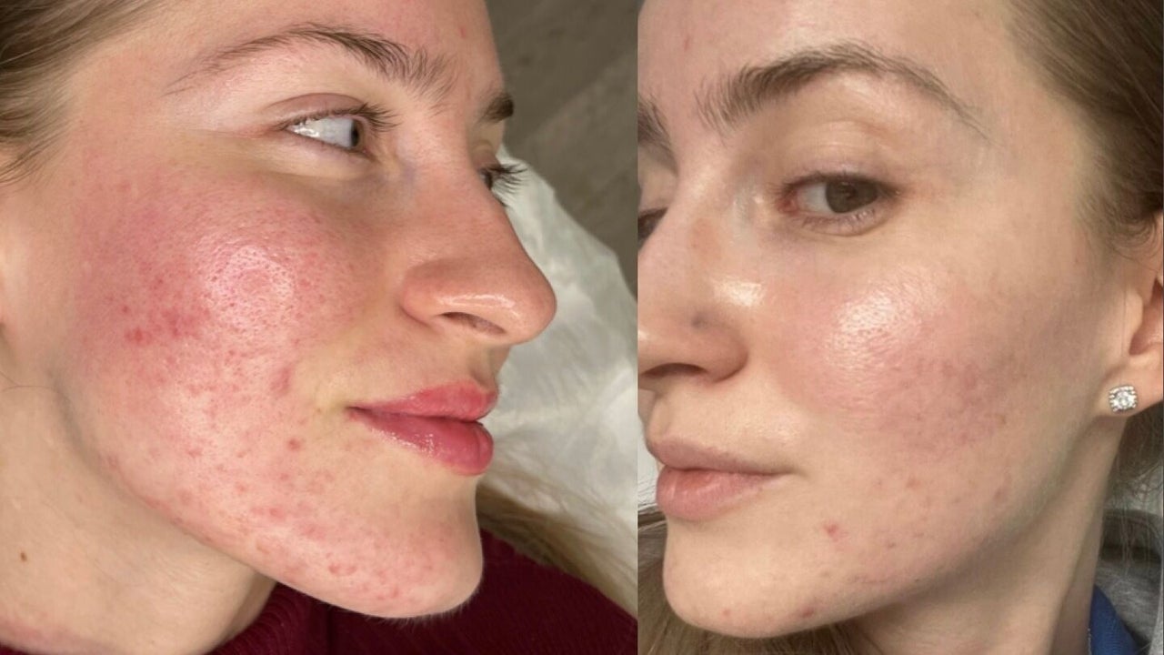 f8878d61-62c5-4132-a4fe-f82c56751826-1700868