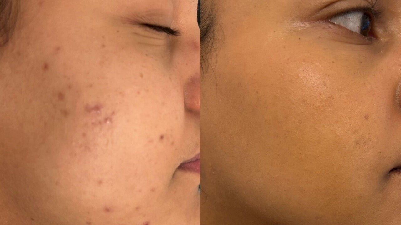 f8cbe7e9-0397-4009-9a52-3d87e3def3b4-glowskin-gb-england-manchester-fresha-4409344