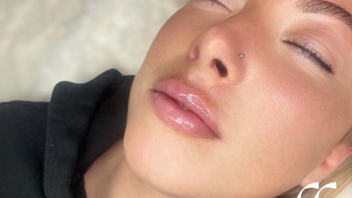 f94e1c90-8ce3-4a0a-9670-3a887831b6ec-pureskinaesthetics-gb-england-kingswinford-westmidlands-fresha-4582266