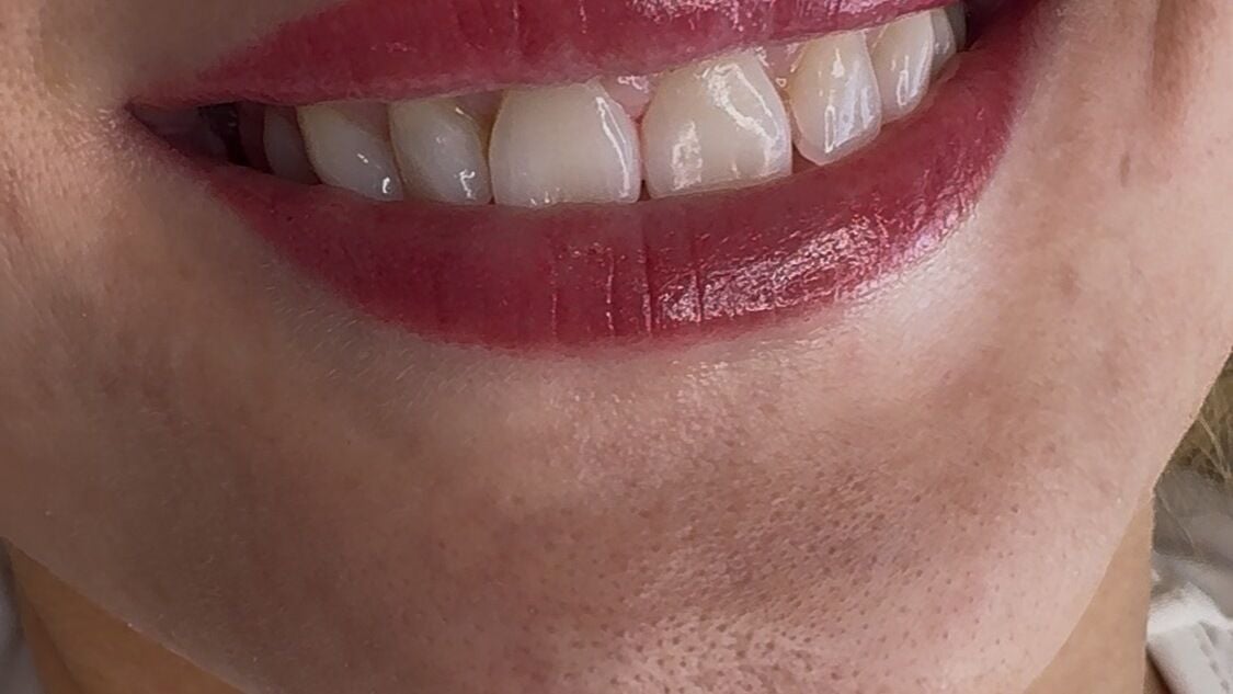 fa8c2ba4-16fa-4ae3-8958-30a1be5eb7b6-dahlynspermanentmakeup-gb-england-liverpool-dahlynsbeautyclinicwaterloo-fresha-3928964