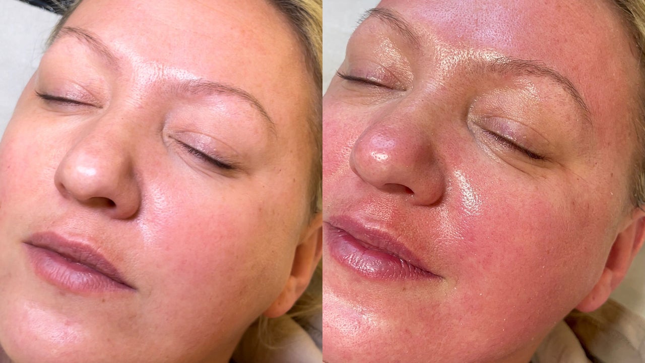 fab90e29-a84c-4fb4-b4a3-dbfd492f829c-karrinacrystallpmulaestheticsskinlbeauty-gb-england-leeds-eastgarforth-fresha-8632657