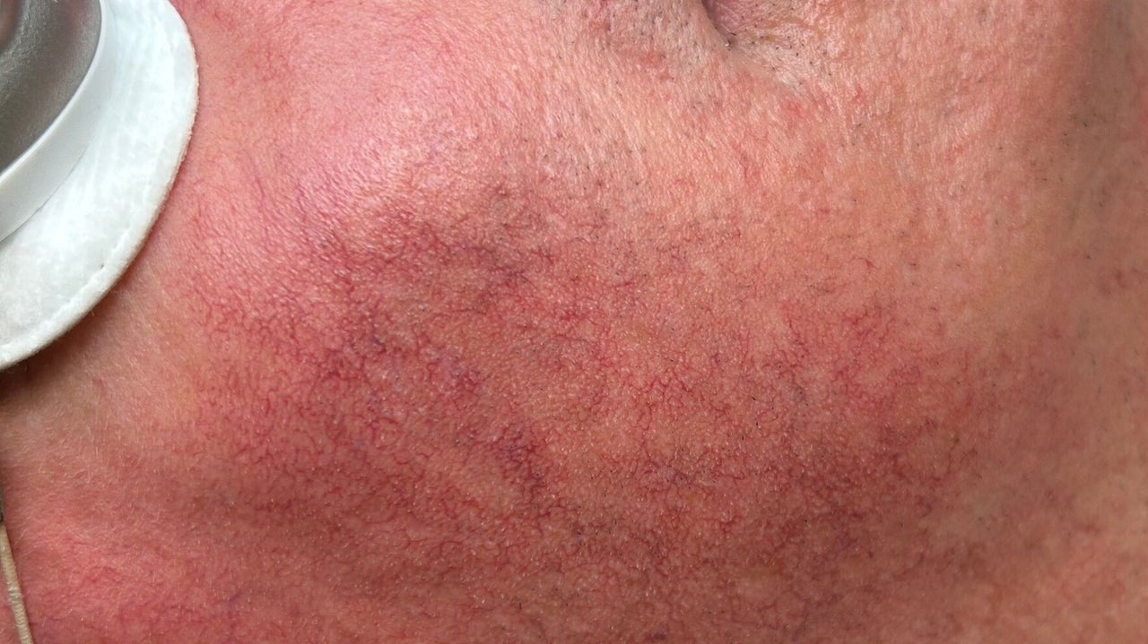 fb85b4d9-a48f-40c4-87f5-a63d4e55d9a7-2382485