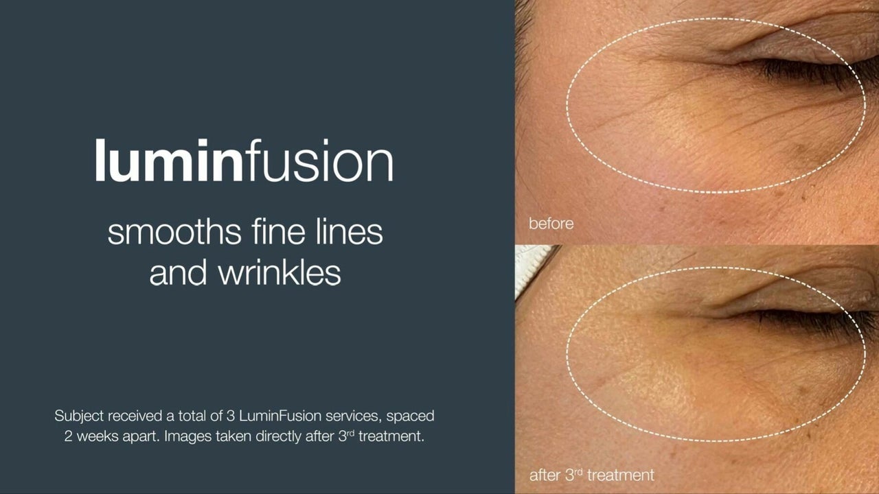 fbf34285-440d-4537-ae47-e3c5cf570aa9-absolutebeauty-gb-england-northampton-duston-fresha-8066156