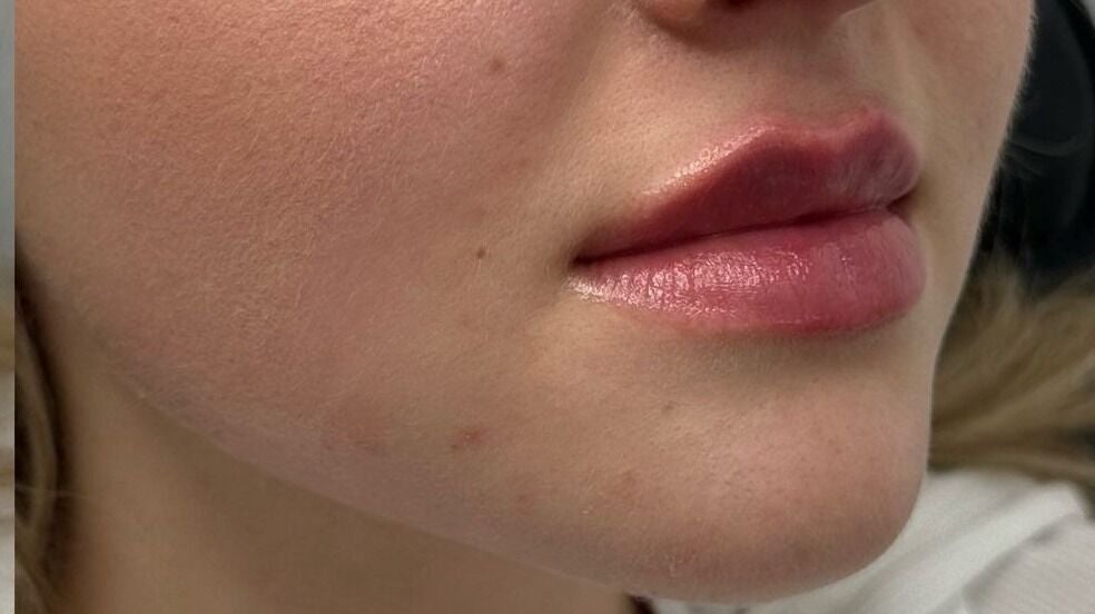 fcec6639-e4d7-4183-887b-e2ffab2090e0-angelwhiteaesthetics-gb-england-littlehampton-fresha-8203937