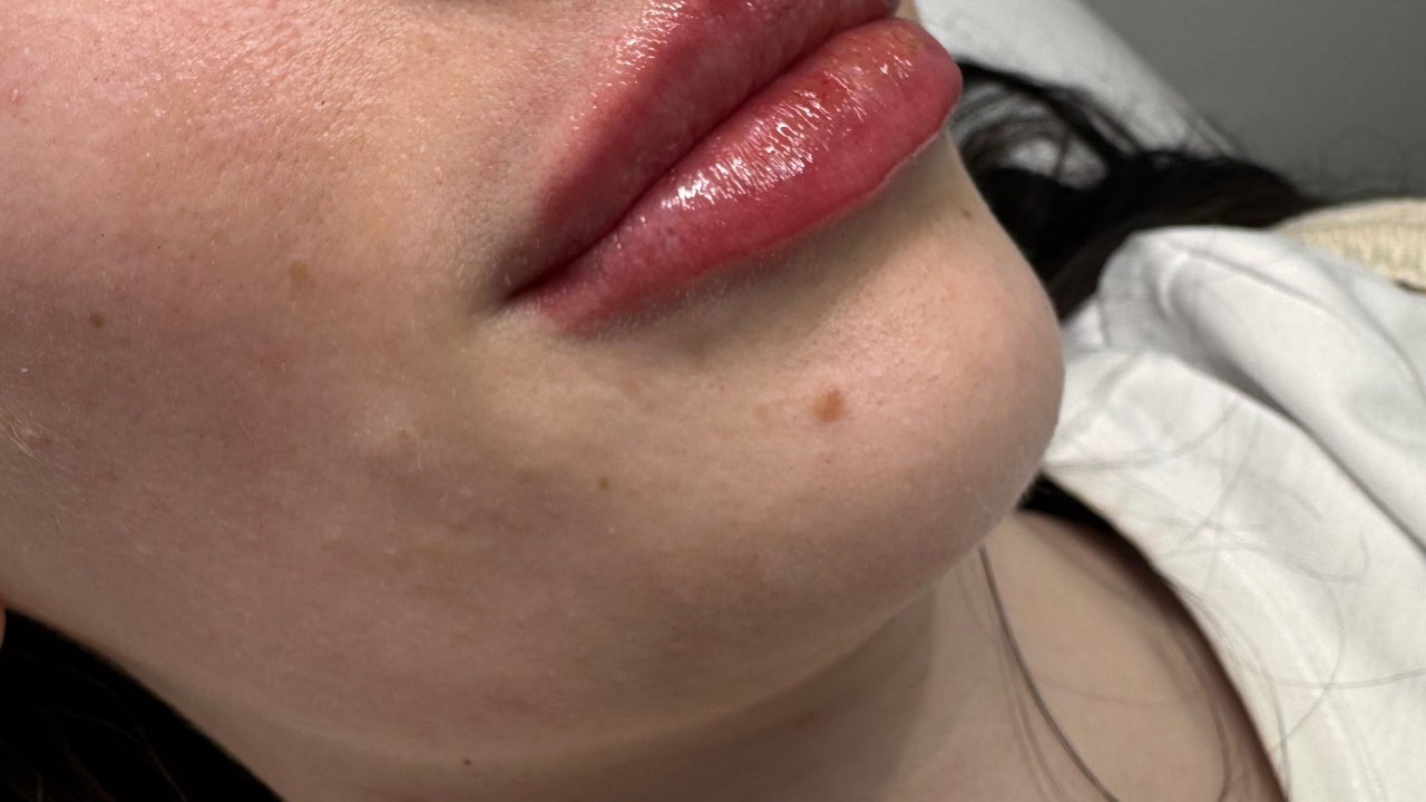 fd5e3680-aaf1-4071-8a88-954de6e2018d-dollyrocksbeautyaestheticslaser-gb-wales-gorseinon-fresha-4392624