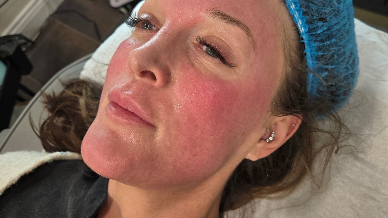 fd5fdc58-0a27-43ab-b7b3-15e303ab0a07-sanctumaestheticsandtrainingacadamy-gb-england-huddersfield-paddock-fresha-5641395