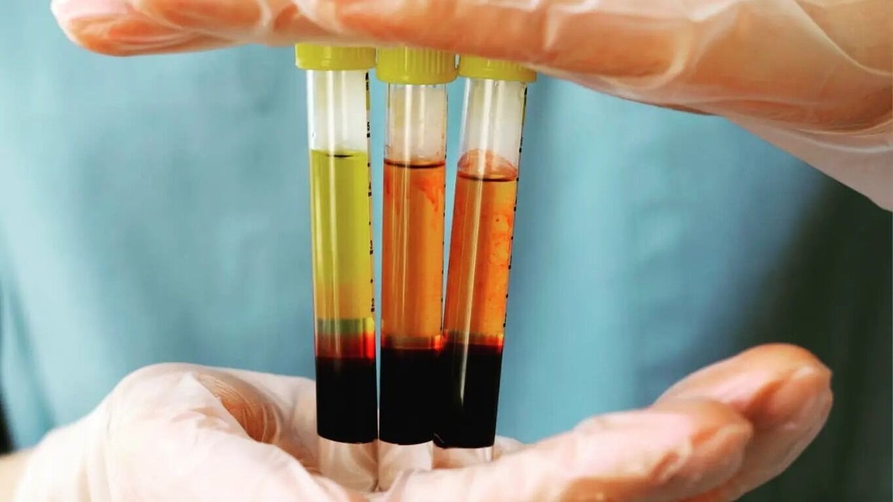 fdcb45e9-0146-4538-b135-7c185fbe94a7-aestheticcarebeautyclinic-gb-england-heywood-fresha-2618609