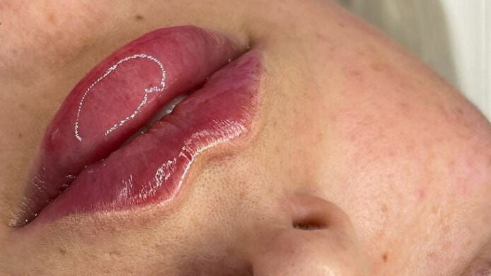 fddc37ba-1df6-4ebe-9de3-be0ee0a77583-chapter25aesthetics-gb-london-albanypark-fresha-2342932