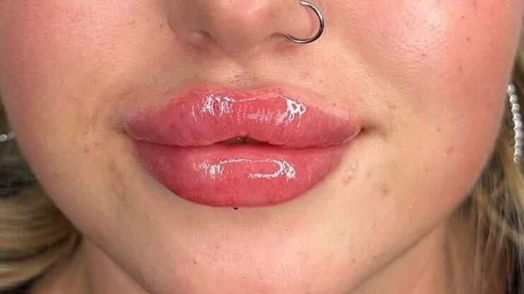 ff445a3c-1dba-4a45-9b0a-16ae42077c97-aspinallaesthetics-gb-england-kingswood-369-375twomilehillroad-fresha-7980928