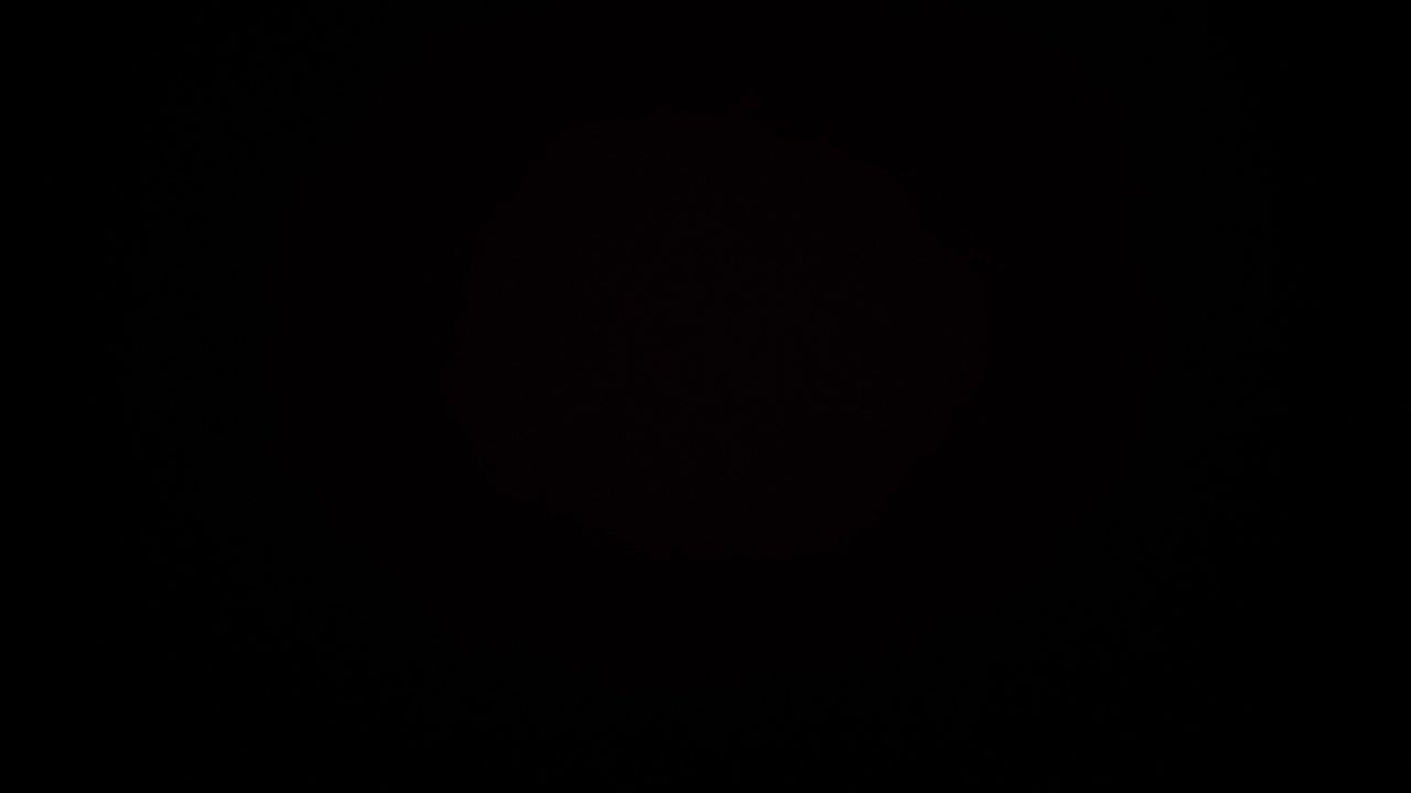 ff44923d-891f-4e44-ba63-7f168c34f7a8-mcraestheticsmanchester-gb-england-worsley-walkdengreatermanchester-fresha-8367620